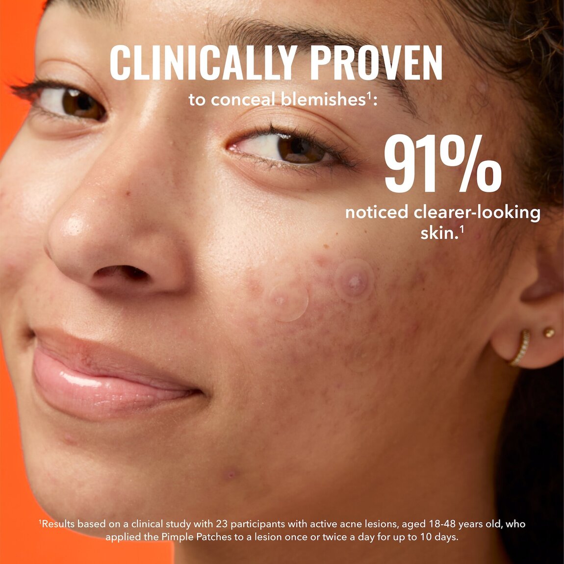 pimple-patches-r6 zb_p.jpg