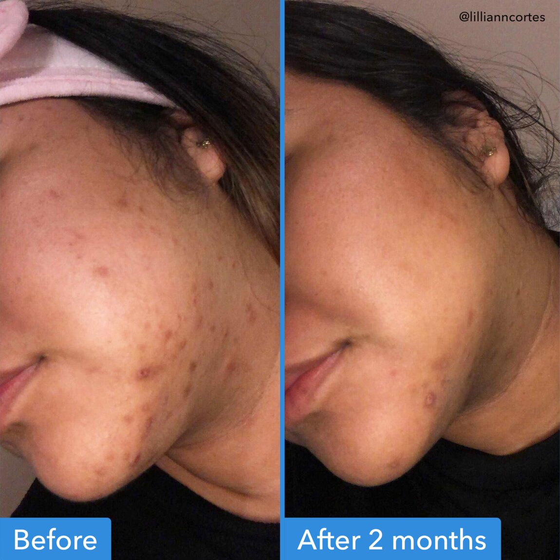 discoloration-correcting-serum-t5 zb_p.jpg