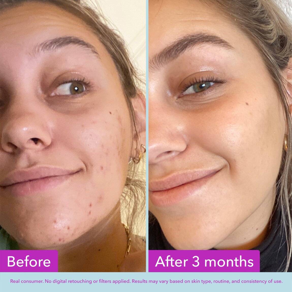 niacinamide-brightening-toner-b9 zb_p.jpg