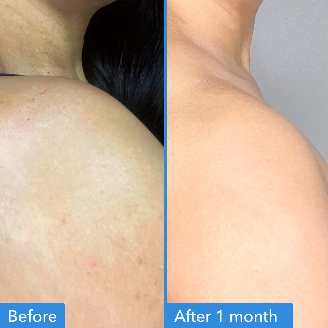 discoloration-correcting-body-treatment-j6 zb_p.jpg